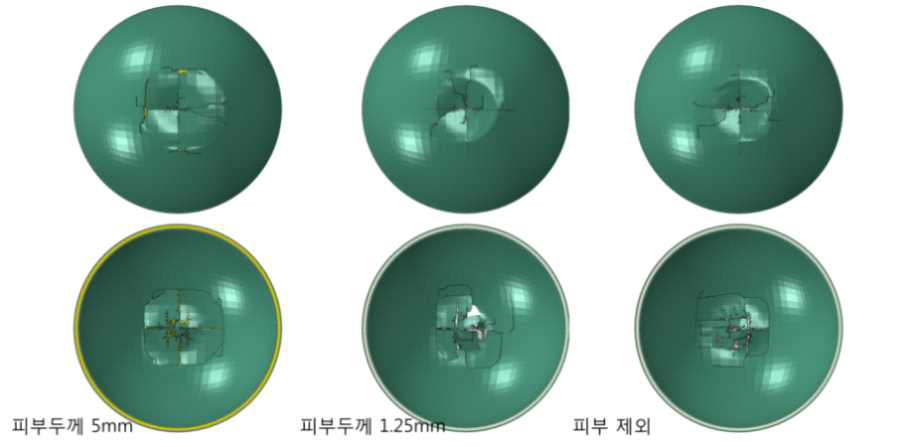 피부의 두께가 두개골의 골절에 미치는 영향: 시험조건 2