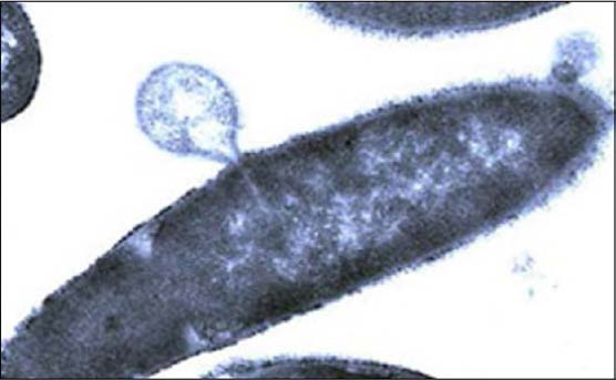 PlyPH에 의한 Bacillus anthracis의 rupture 전자현미경 사진