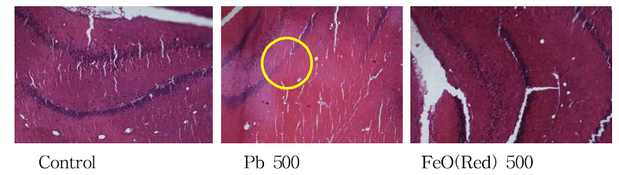 랫드 뇌 조직에서의 납과 적색 산화철 장기 독성에 대한 비교(x100)