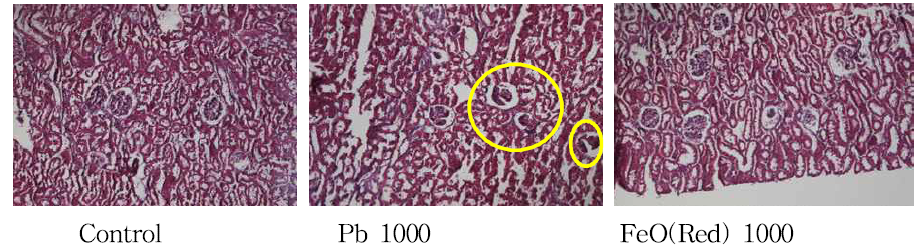 랫드 신장 조직에서의 납과 적색 산화철 장기 독성에 대한 비교(x100)