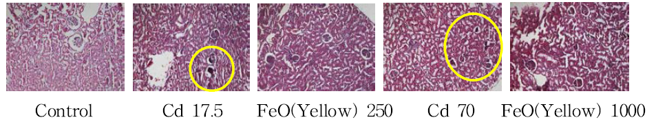 랫드 신장 조직에서의 카드뮴과 황색산화철 장기 독성에 대한 비교(x100)