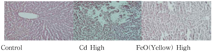 랫드 간 조직에서의 카드뮴과 황색산화철 단기 독성에 대한 비교(x200)