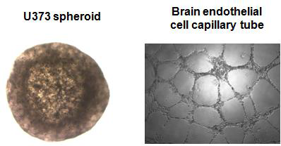 암세포주의 sphere 형성과 혈관세포의 capillary 형성