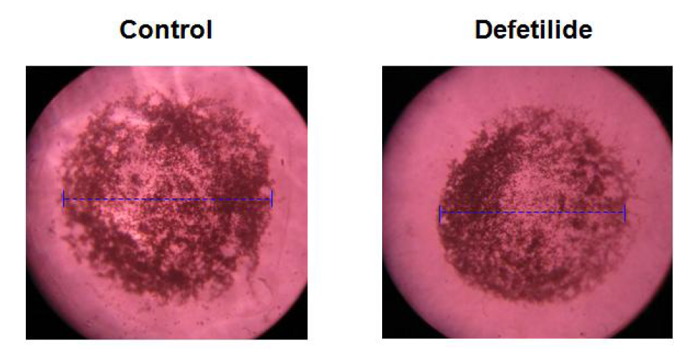 Defetilide의 3D 배양에서 암세포-혈관세포의 상호작용 억제 효과