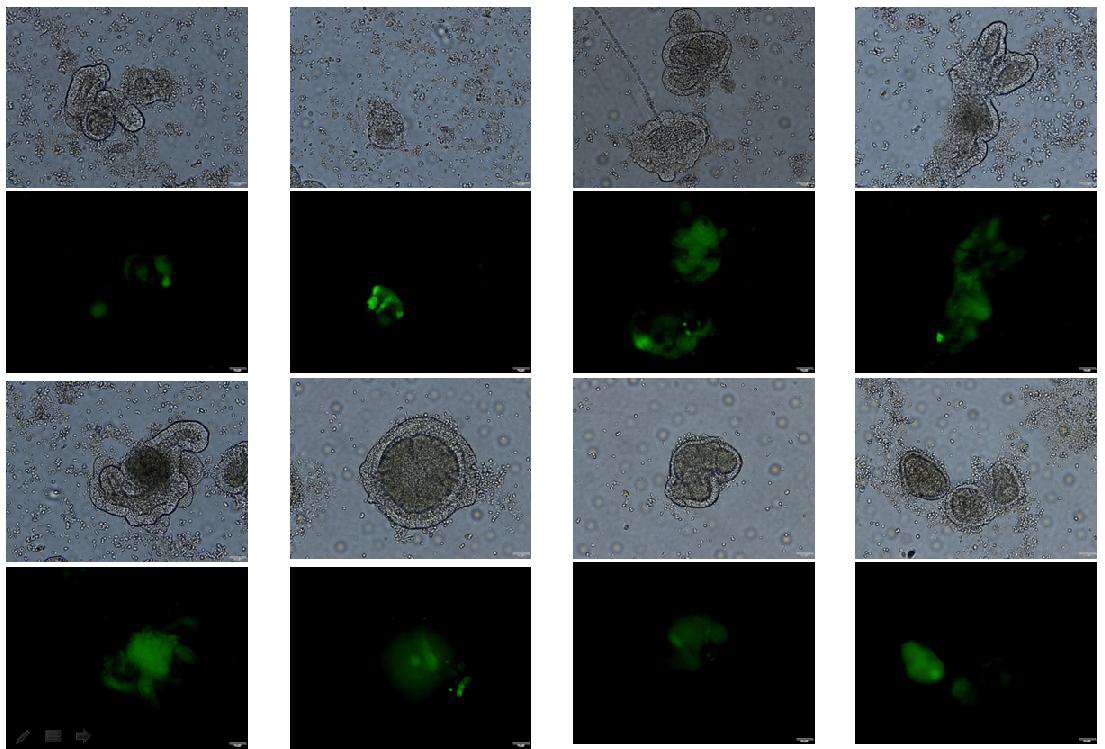 adenovirus with GFP를 transduction한 mouse jejunal organoid
