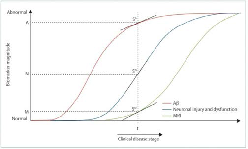 알츠하이머 치매의 진행정도에 따른 베타아밀로이드 침착정도 (붉은색), 신경손상과 기능장애 (파란색) 및 MRI상 뇌구조의 변화 (초록색)