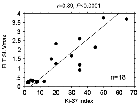 Linear regression analysis FLT SUV and Ki-67 index in patients with newly diagnosed glioma