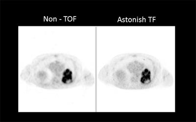 Astonish TF를 이용한 영상화