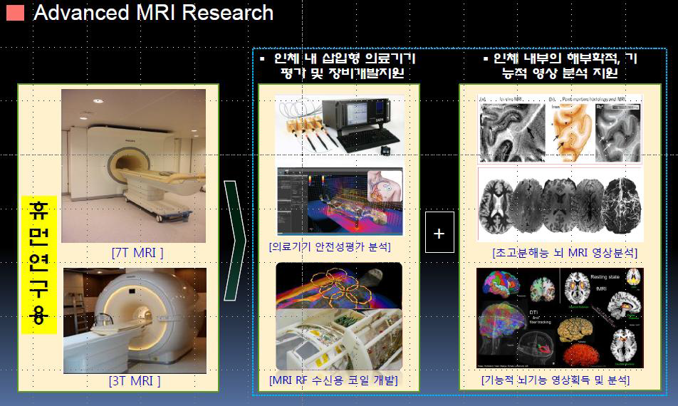 고자장 MRI 시스템 연구 영역