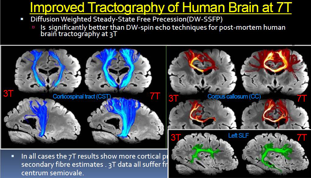 3.0T 및 7.0 MRI 시스템에서 뇌영역의 확산강조영상 비교