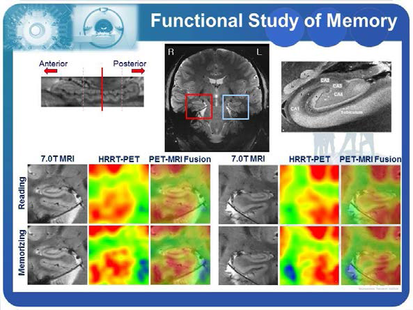 7T MRI 및 HRRT-PET 시스템을 이용한 뇌과학 연구