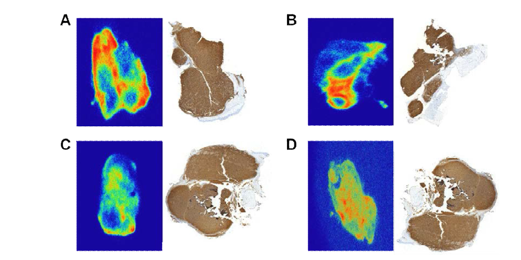 CD-20 발현 세포주 Xenograft의 CD-20을 IHC와 Autoradiography 로 확인