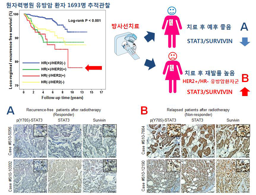 HER2subtype에서 방사선저항성 판별인자 STAT3/SURVIVIN