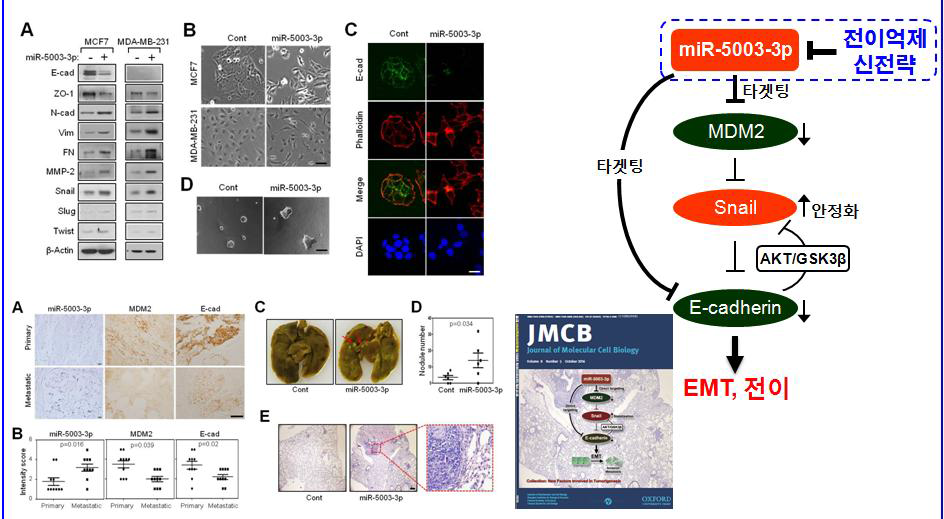 miR-5003-3p의 유방암세포 EMT/전이 촉진 분자기전 규명