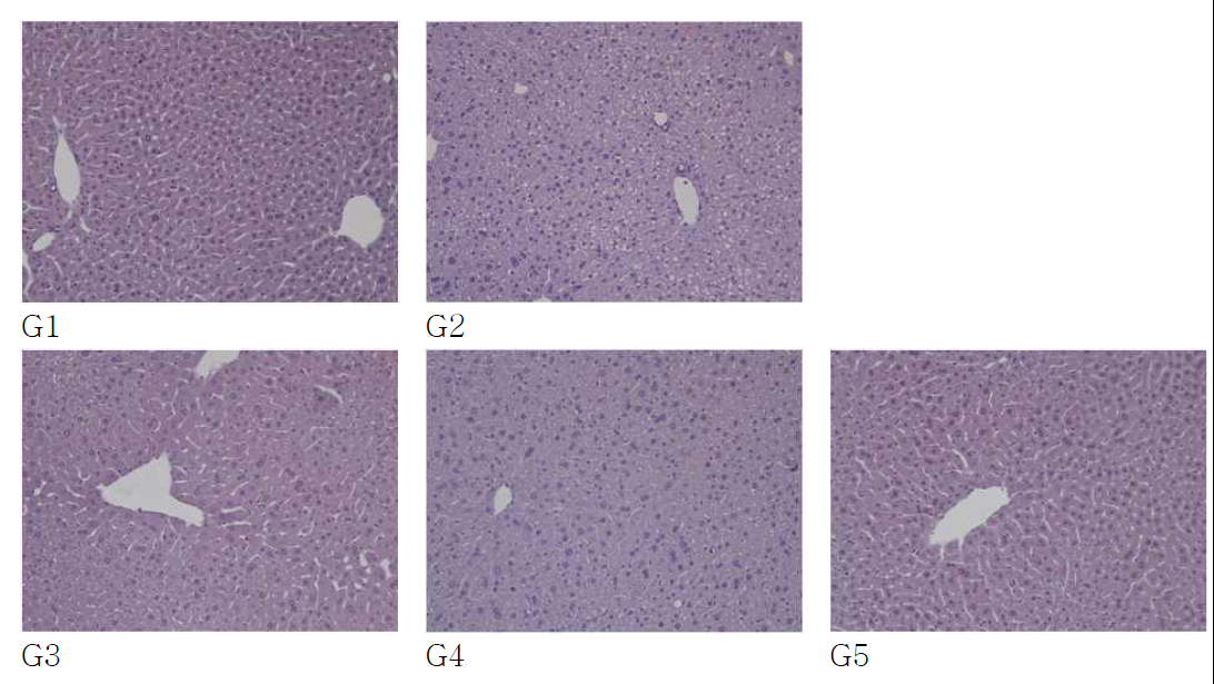 고 콜레스테롤 식이를 먹인 쥐에서 녹차 기름 추출물의 효과를 H&E 염색 을 통해 간세포의 morphology 분석.