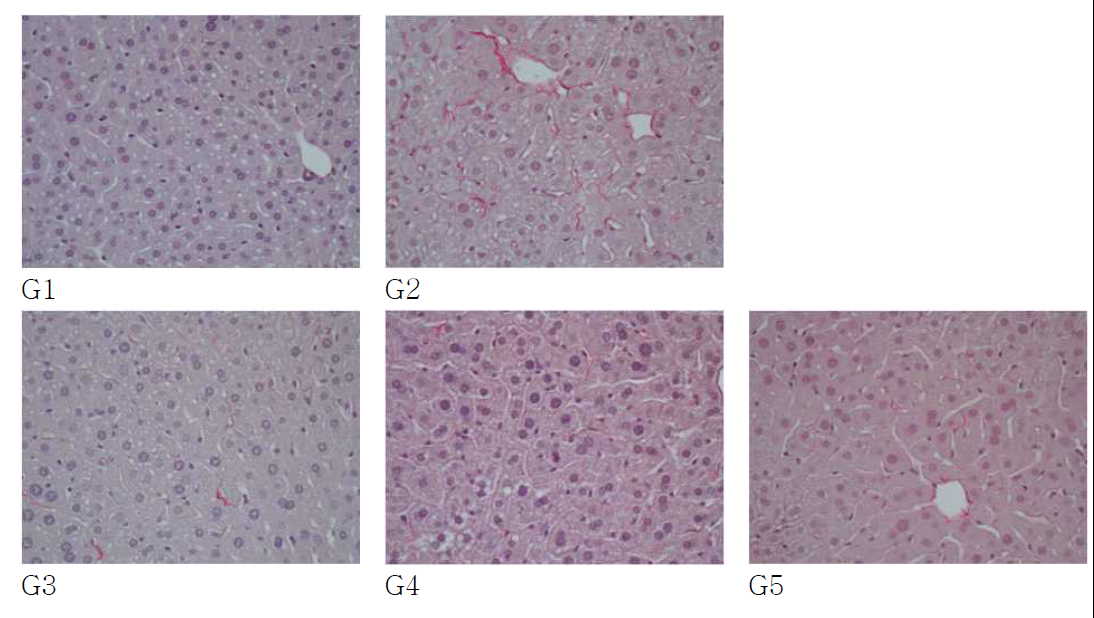 고 콜레스테롤 식이를 먹인 쥐의 간조직에서 녹차 기름 추출물의 항섬유화 효과를 Picrocirius 염색을 통해 분석.