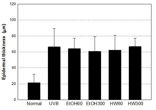 Effects of UVB irradiation on the epidermal thickness