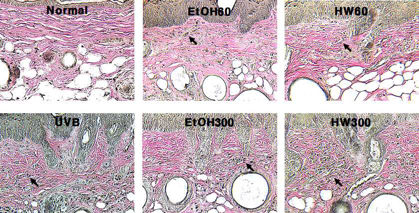 Histological observation of SKH-1 hairless mouse by white rose extract