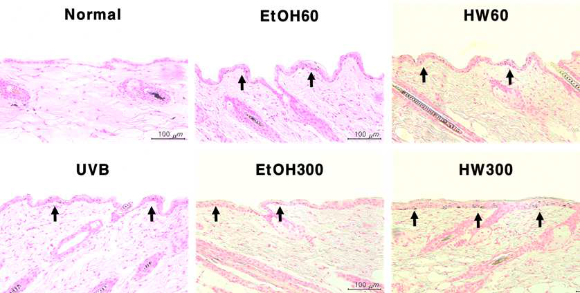 Histological examination of dorsal skins of DBA2 mice exposed UVB