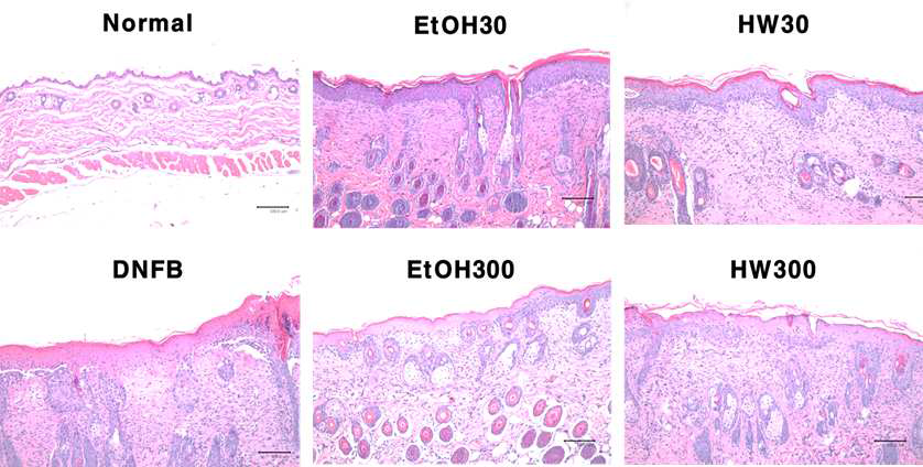 Histopathological changes in DNFB-induced chronic atopic dermatitis