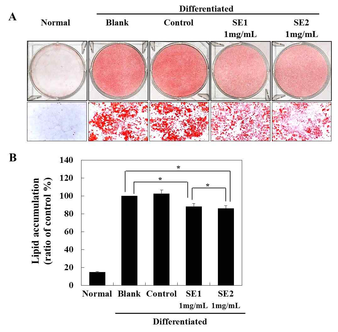 Effect of SEs on adipocyte differentiation and lipid accumulation