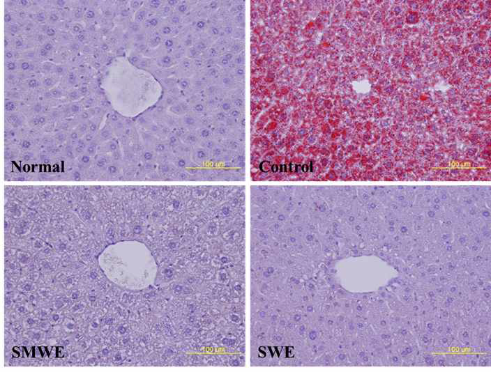 Oil Red O staining of liver