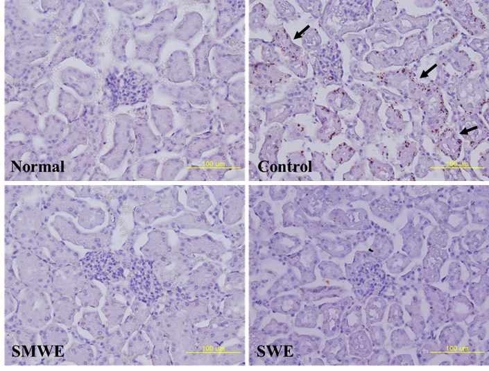 Oil Red O staining of kidney