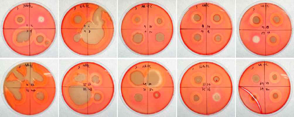 Cellulase activity of sigumjang