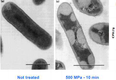 Listeria monocytogenes 전자현미경 사진