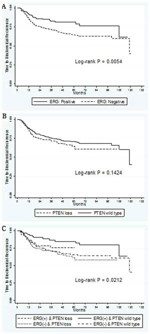 Biochemical recurrence free survival curve according to expression of ERG and PTEN.