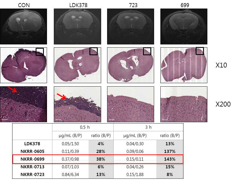 뇌전이암 모델에서의 ROS1 저해제 in vivo efficacy 검증