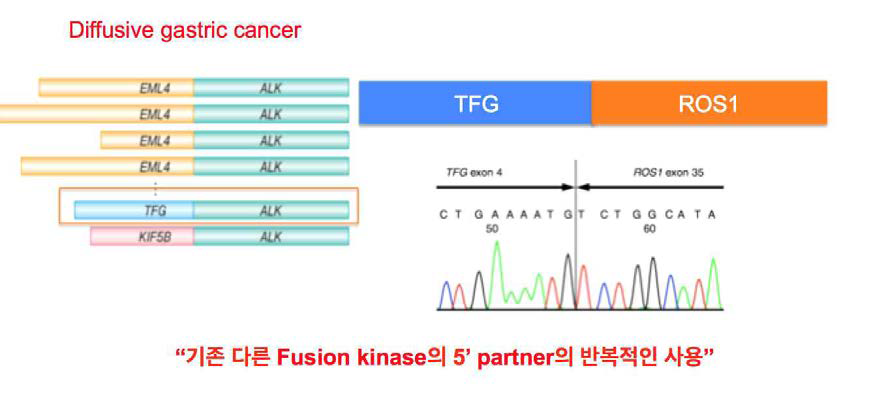 미만성 위암에서 새로운 ROS1-FUSION단백질 발견