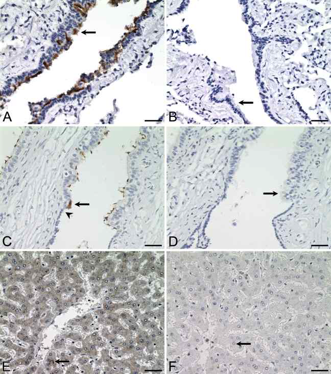 Distribution of ALDH3B1 in human lung, testis, and liver.