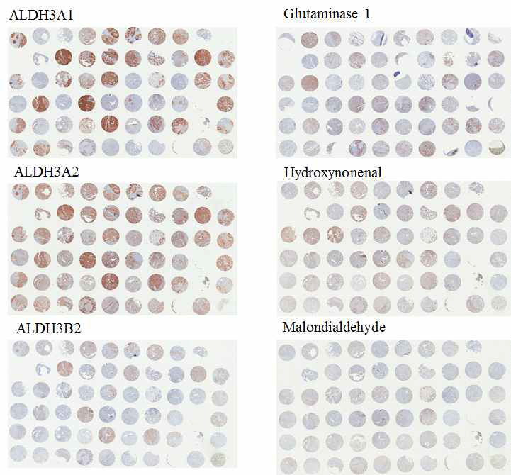 Tissue microarray를 이용하여 조직면역화학염색을 시행한 결과.