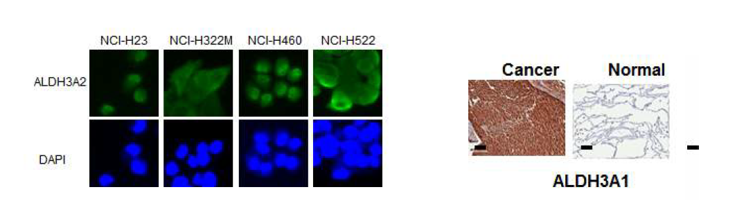 4가지 NSCLC 암세포주에서 ALDH3A2를 염색한 결과 모든 암세포에서 염색 되고 있음