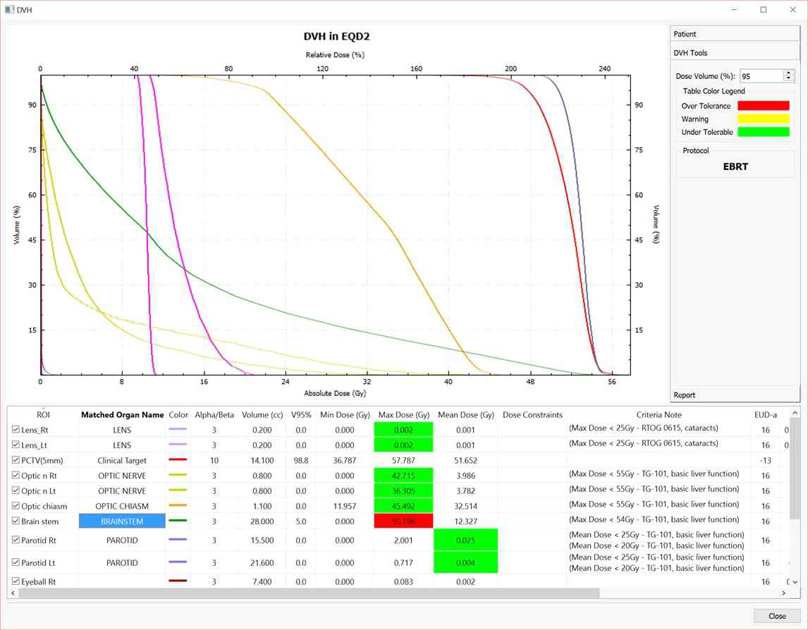 개발된 DVH & Dose Validator 프로그램을 이용하여 치료계획을 평가한 예.