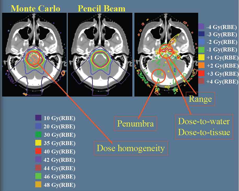 선량계산 알고리즘의 비교 (Monte Carlo, Pencil beam algorithm)