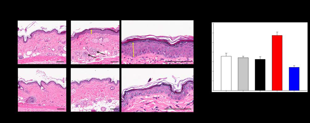 TiO2와 탄닌산/TiO2 유무기 복합 소재의 (a) in-vivo 장기 독성 안전성 테스트 및 (b) 자외선 조사에 따른 피부 자극 조사를 위한 마우스 피부 조직 분석 사진. (c) 자외선 조사에 따른 표피층 두께 변화 비교 그래프.
