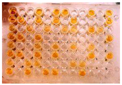 ELISA test results in a 96-well plate.