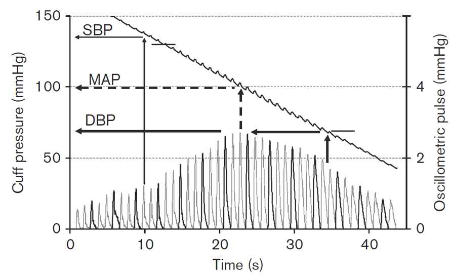 자동혈압계의 혈압측정 원리 및 진동파 파형에 따른 평균동맥압 측정 방식