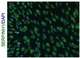 섬유아세포의 면역화학적 염색