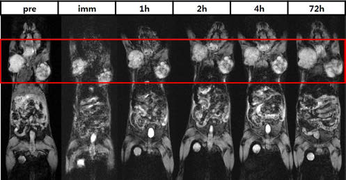 유방암 세포주를 마우스의 유방에 이식 한 후 T2* 영상을 통해 확인
