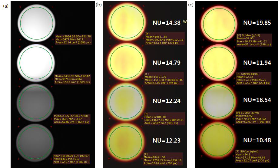 (a) The T2 image on uniformity plane after image stitching and (b) PET image on uniformity plane without and (c) with AC