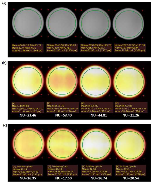 (a) The T2 image of uniformity plane on horizontal set up phantom and the PET image of uniformity plane on horizontal set up phantom (b) without and (c) with AC