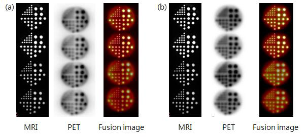 The images of (a) MRI, PET without AC, and PET(NAC)/MR fusion, (b) MRI, PET with AC, and PET(AC)/MR fusion (from left to right).