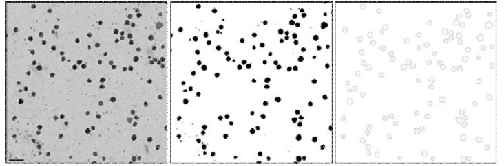 은 나노입자의 투과전자현미경 관찰 결과와 이미지 처리