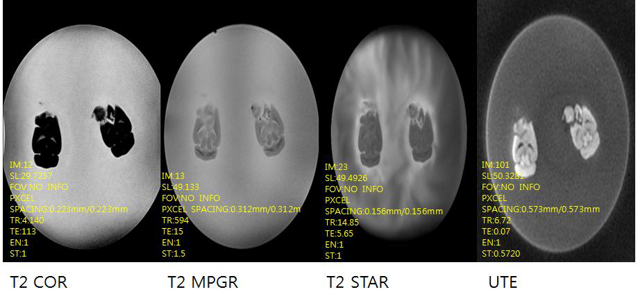 마우스 뇌를 적출하여 네가지 종류의 다양한 자기공명영상 시퀀스로 확인하여 영상 최적화를 위한 펄스열 확립.