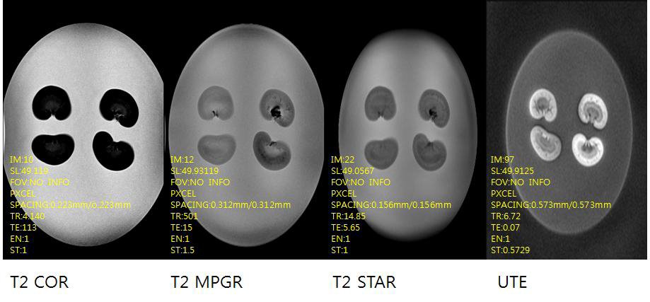 마우스 신장을 적출하여 네가지 종류의 다양한 자기공명영상 시퀀스로 확인하여 영상 최적화를 위한 펄스열 확립.