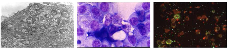 Photographs of Orientia tsutsugamushi causing scrub typhus: Electron microscopy (Left), Giemenez-staining (Center), and immunofluorescence-staining (Right)