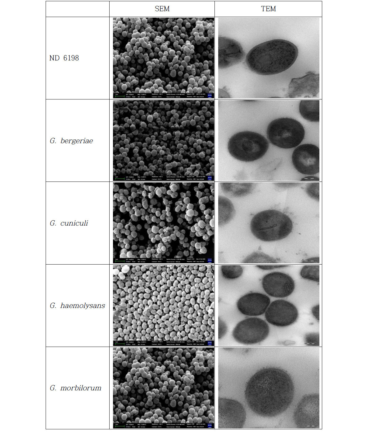 Scanning Electron Microscopy (SEM)과 Transmission Electronic Microscopy (TEM) 분석